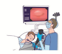 胃内視鏡検査を受けている人